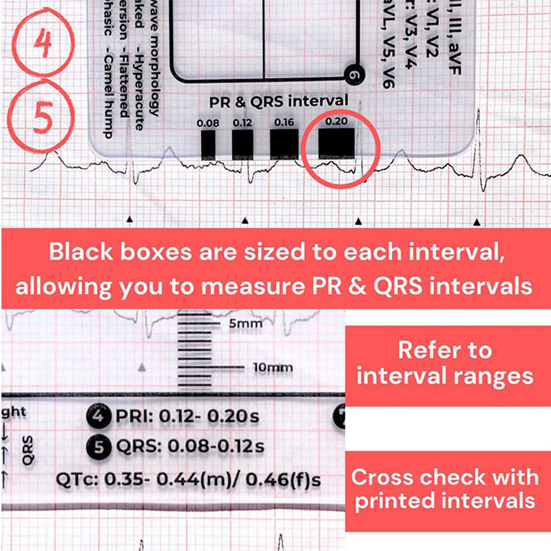 ECG 7 Step Ruler