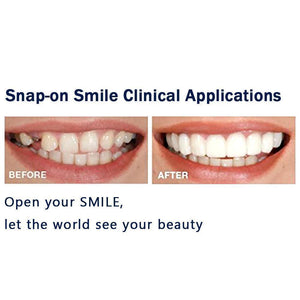 Magic Smile Teeth Brace