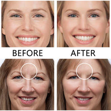 Load image into Gallery viewer, Face Nutrition Wrinkle Removal Lift Stickers