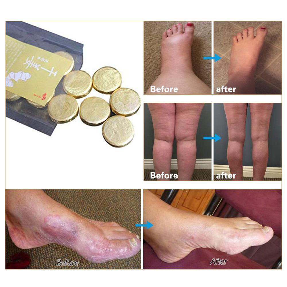 Anti-Swelling & Fungal Foot SPA