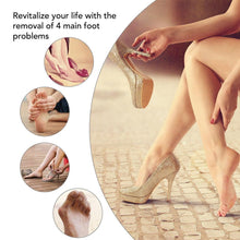 Load image into Gallery viewer, Hirundo Thumb Valgus Corrector, Elastic Bunion Corrector, 1 Pair