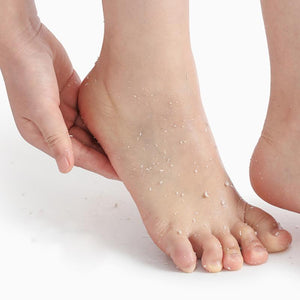 Foot Peeling Spray